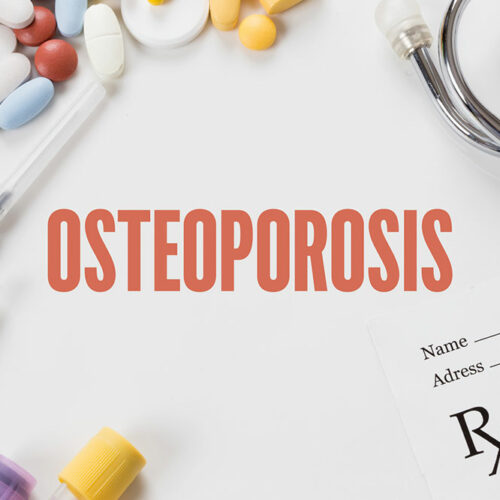 7 Conditions That Increase the Risk of Osteoporosis