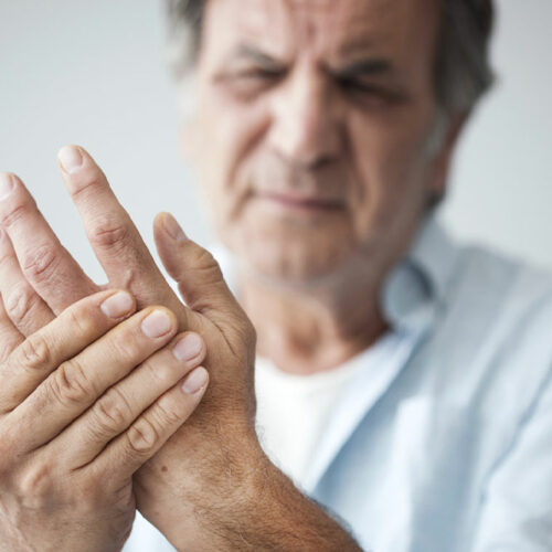 7 mistakes that can aggravate rheumatoid arthritis