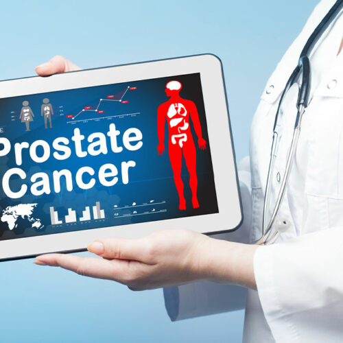 3 tips to help prevent and manage prostate cancer