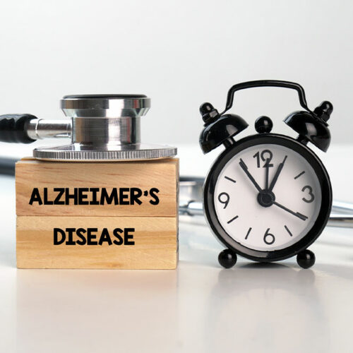 Alzheimer&#8217;s disease &#8211; 7 tips to manage the condition