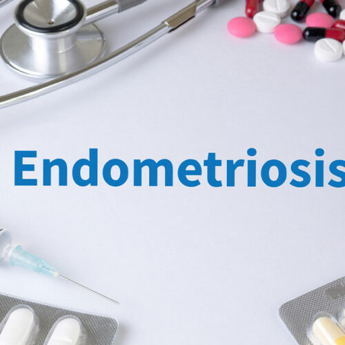 Endometriosis &#8211; Symptoms and natural remedies