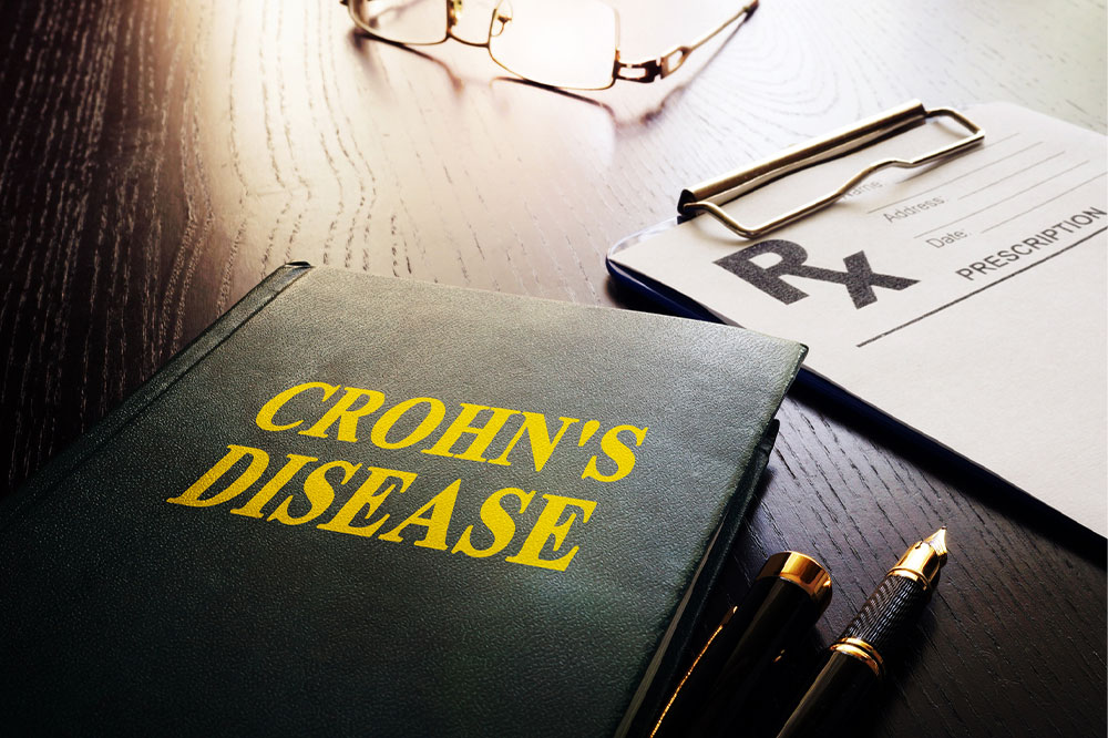 Top 10 early warning signs of Crohn&#8217;s