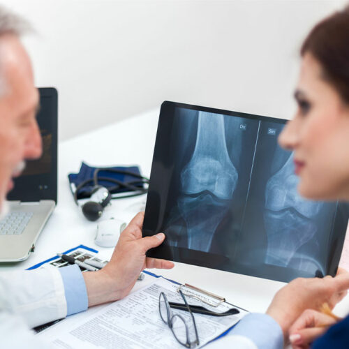 8 warning signs of low bone density