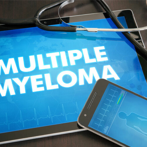 14 Signs of Multiple Myeloma to Look Out for